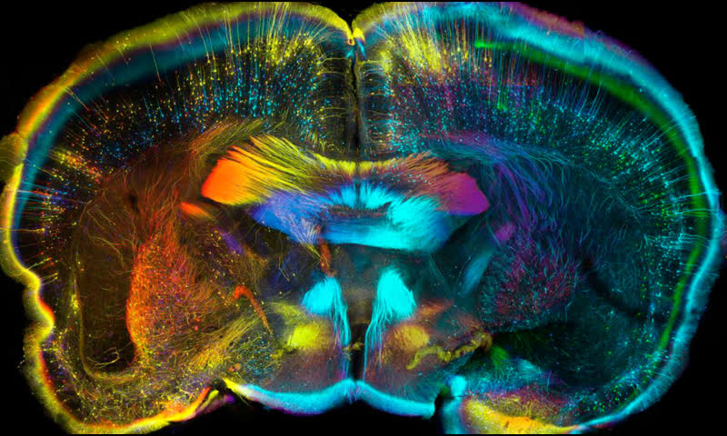 Самоотражение мозга: фантастические снимки головного мозга